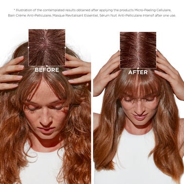 Symbiose Micro-Peeling Cellulaire - Kérastase | L'Oréal Partner Shop