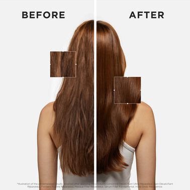 Sérum Filler Fondamental - Videresalg | L'Oréal Partner Shop